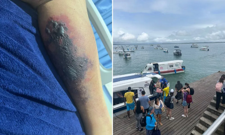 Turista morre após picada de aranha-marrom em Morro de São Paulo