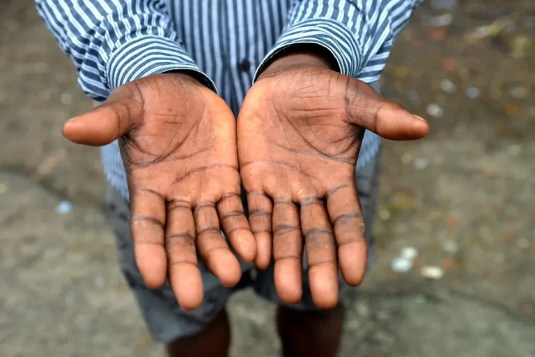 Denúncia revela trabalho infantil e condições análogas à escravidão em obra de condomínio em Guarajuba